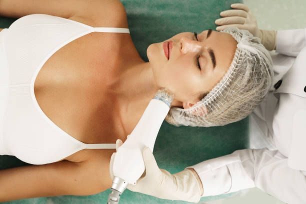 Before and after Radio Frequency Microneedling results at Viore Laser Skincare MedSpa, example 3