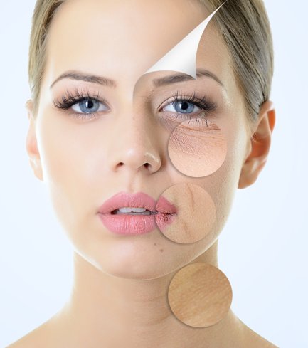 Face showing skin aging concerns around the eyes, mouth and neck that skin rejuvenation treatments address